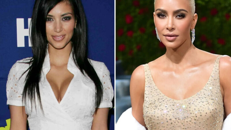 The Most Shocking Celebrity Plastic Surgery Transformations of All Time